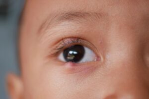 bolinhas no olho o que pode ser